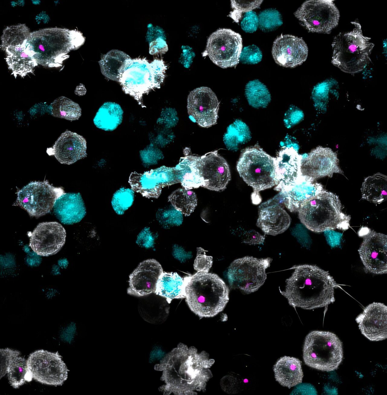 CAR-T cells enhanced with navigation system to penetrate lymph nodes more efficiently - Genix Fertility Care
